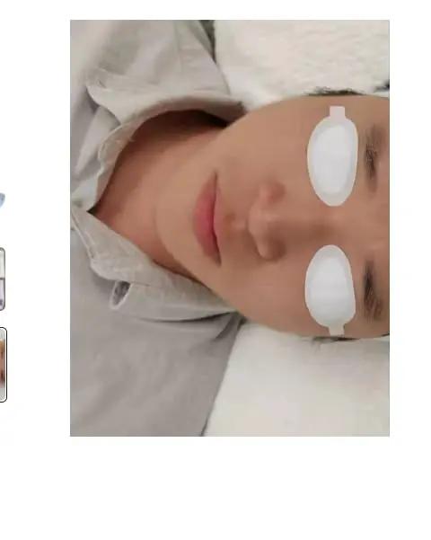 Pro Grade Disposable Eye Shields For Laser Ipl Led Facials Od7 Rated blocking light on a client's closed eyes during treatment.