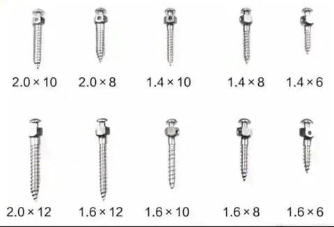 No Fuss Pro Grade 5 Piece Dental Micro Screw Set NiTi Alloy Orthodontic Anchors displayed with various sizes and lengths.