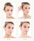 24K Gold Pulse Facial Massager T Shape Electric Face Massage Tool For Sensitive Skin Tightening Firming Lifting Anti Aging Skincare Gadget For Daily Use Battery Operated At Home Spa Vibe used on cheek and chin before after