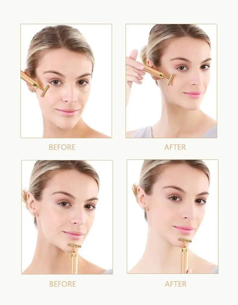 24K Gold Pulse Facial Massager T Shape Electric Face Massage Tool For Sensitive Skin Tightening Firming Lifting Anti Aging Skincare Gadget For Daily Use Battery Operated At Home Spa Vibe used on cheek and chin before after