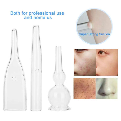 3pc Vacuum Glass Tube Kit for Face Suction Blackhead Removal and Pore Vacuum Cleaner Deep Clean Tool Set images