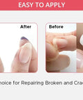 Ultimate Nail Savior Repair Kit For Broken And Cracked Tips Featuring Hassle Free Brush On Glue Gel showing before and after nail repair.