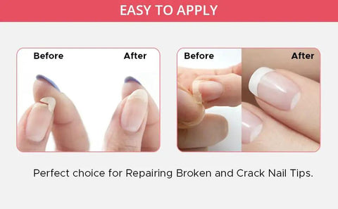 Ultimate Nail Savior Repair Kit For Broken And Cracked Tips Featuring Hassle Free Brush On Glue Gel showing before and after nail repair.