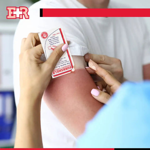 Person applying dressing from Grab And Go Burn Care Kit With All Natural Tea Tree Oil Gel And Dressing For Common Burns And Scalds