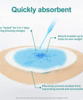 Sacral Wound Dressing Foam Bandage With Silicone Border showing absorption and liquid handling for bed sore pressure wounds.