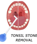 Manual Vacuum Tonsil Stone Remover Kit With Safe PVC Glass Tube For Adults Dental Suction Mouth Cleaner Right Angle Design