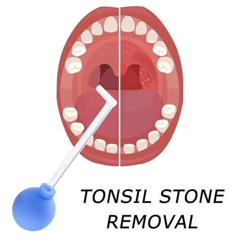 Manual Vacuum Tonsil Stone Remover Kit With Safe PVC Glass Tube For Adults Dental Suction Mouth Cleaner Right Angle Design