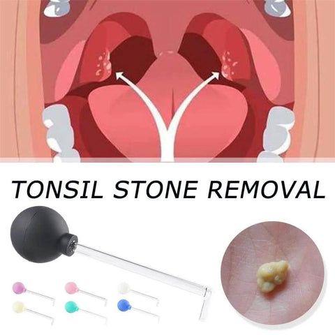 Manual Vacuum Tonsil Stone Remover Kit With Safe PVC Glass Tube For Adults Dental Suction Mouth Cleaner Right Angle Design image