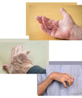 BendEase Hand Splint For Wrist Pain Relief And Carpal Tunnel Support visual of hands needing support.