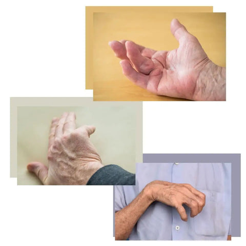 BendEase Hand Splint For Wrist Pain Relief And Carpal Tunnel Support visual of hands needing support.