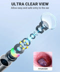 Digital Otoscope For iPhone And Android HD Ear Camera With Ear Wax Removal Tools video showing lens structure and ear cavity