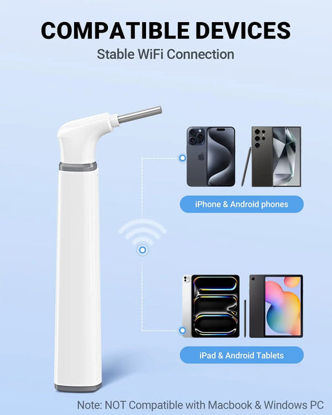 Ultra Thin 3.9mm Ear Otoscope Camera With Light For HD Ear Inspection At Home Kid And Adult Friendly Movement Sensitive Clear Inside View Safe Easy Peasy Ear Checks And Ear Health Tool, white WiFi model with iPhone, iPad and Android support