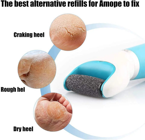 Pro Grade 13 Pack Replacement Rollers For Pedi Perfect Refills Electronic Foot File, showing callused heels and roller close-ups.