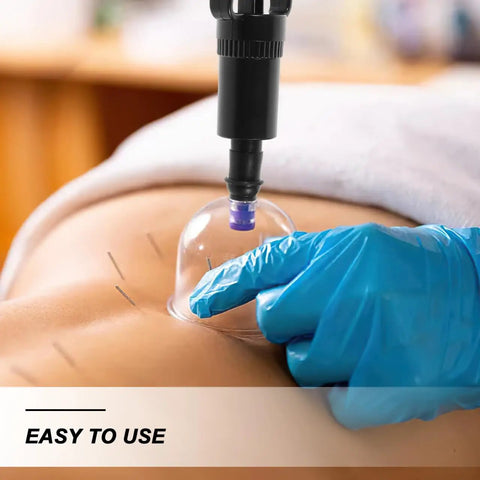 Universal Replacement Manual Cupping Pump With Ergonomic Grip for Vacuum Cups in use on back with gloved hand.
