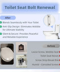 Stainless Steel Toilet Seat Screws Kit With Expanding Rubber And Plastic Nuts Universal Top Mount Bolts Replacement benefits