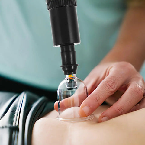Universal Replacement Manual Cupping Pump with Ergonomic Grip in use on skin with clear vacuum cup attachment