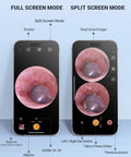 Digital Otoscope For iPhone And Android HD Ear Camera with screen modes displayed on phones for ear inspection and health check.