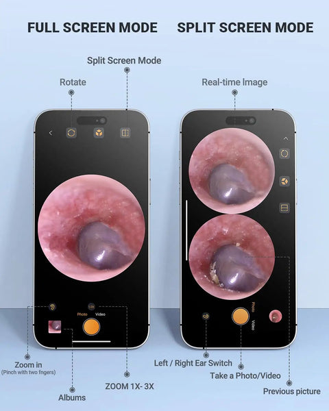 Digital Otoscope For iPhone And Android HD Ear Camera with screen modes displayed on phones for ear inspection and health check.