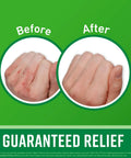 Before and after results using Working Hands Hand Cream And Healthy Feet Foot Cream Duo For Extremely Dry Cracked Hands And Feet.