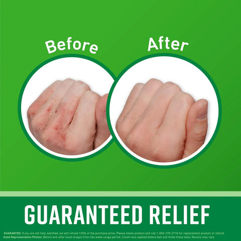 Before and after results using Working Hands Hand Cream And Healthy Feet Foot Cream Duo For Extremely Dry Cracked Hands And Feet.