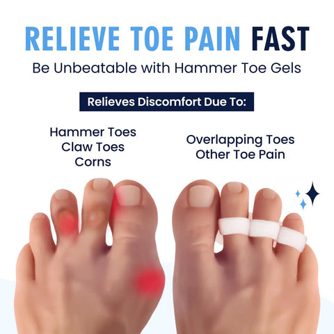 Hammer Toe Corrector Gels With All Day Relief For Crooked And Overlapping Toes Soft Cushioned Support Symptomatic Toe Alignment White 3 Loop Design 2 Pairs Comfortable Gel Fit For Men And Women diagram with red toe pain marker