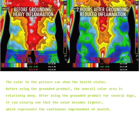 Thermal image comparison showing inflammation improvement using grounding sheet with grounding cord.