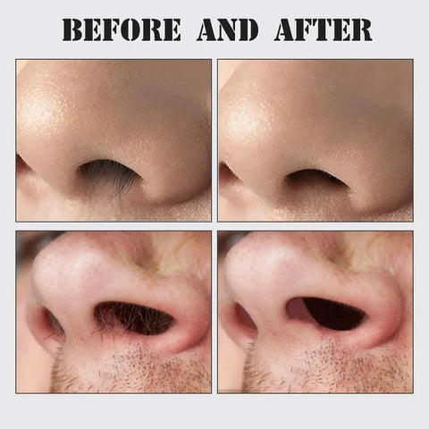 Before and after use of 360 Degree Rotating Nose And Ear Groomer 2 In 1 Nasal Hair Cutter With Dual Stainless Steel Blades.