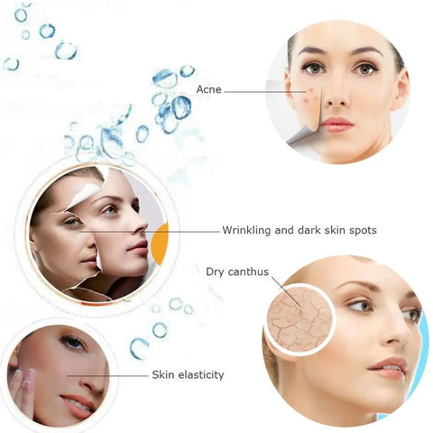 Facial skin issues infographic with acne, dryness, and elasticity, highlighting benefits of At Home Facial Steamer For Spa Level Steam And Sinus Inhaler Delivers Soothing Hydration For Skin With Aromatherapy Diffuser And Humidifier Great For Relaxation Pore Cleansing And Moisturizing Facial Mask Purple.