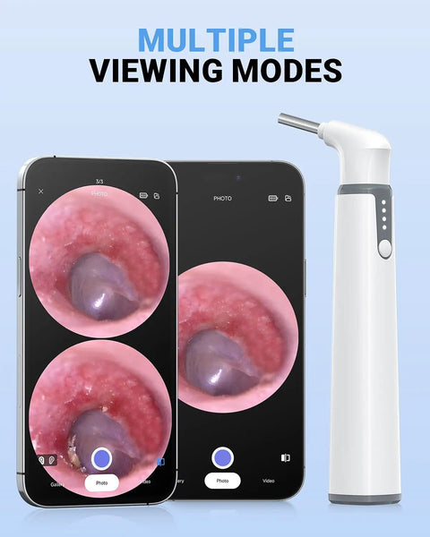 Ultra Thin 3.9mm Ear Otoscope Camera With Light For HD Ear Inspection At Home Kid And Adult Friendly Movement Sensitive Clear Inside View Safe Easy Peasy Ear Checks And Ear Health Tool, shown with phone screen views