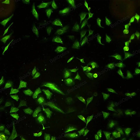 Inverted Fluorescence Microscope 100X-400X, Trinocular With Halogen Lighting, green fluorescent cells on black background