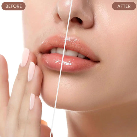 Before and after using Go-To Facial Hair Remover For Women With Built-In Light And Stainless Steel Blade on lip area.