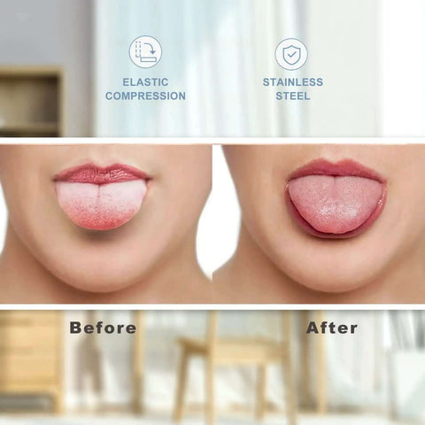Before and after using Two Pack Tongue Scrapers Made From 304 Stainless Steel For Adults And Kids, showing fresher looking tongue