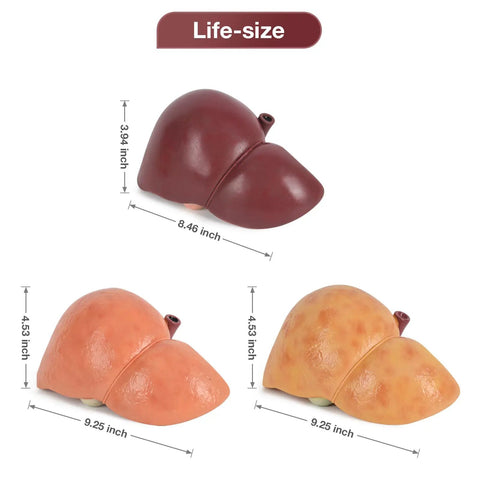 Hella Realistic Silicone Liver Anatomy Set Featuring Three Straight Up Life Size Medical Teaching Models with normal and fatty liver versions.