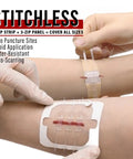 Application of 4 Pack Zip Stitch Wound Closure Devices For Quick Suture Free Repair Of Cuts And Lacerations on arm
