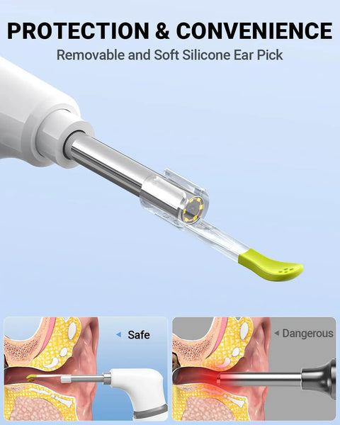 Ultra Thin 3.9mm Ear Otoscope Camera With Light For HD Ear Inspection At Home Kid And Adult Friendly Movement Sensitive Clear Inside View Safe Easy Peasy Ear Checks And Ear Health Tool, soft silicone ear pick tip