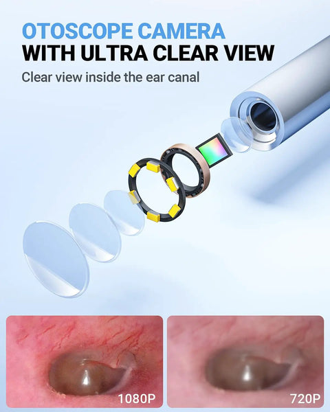 Home Ear Otoscope With 4.5 Inch IPS Display And 3.9mm Ear Camera With Gyroscope For Clear At Home Inspection, 6 LED Lights Illuminate Earwax Irritation And Blockages, No App Required, No WiFi Needed, HD Ear Camera For Safe Self Check, FSA HSA Eligible, exploded lens view