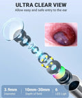 Digital Ear Otoscope With Gyroscope And 4.5 Inch Screen, 3.9mm Inspection Camera With Six LED Lights For Easy Ear Wax Removal, 32GB Card, Snap Photos And Record Videos, Your Own Ear Doctor At Home Checkup, 3.9mm lens and 6 LED lights
