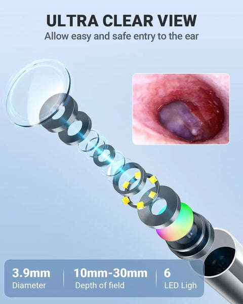 Digital Ear Otoscope With Gyroscope And 4.5 Inch Screen, 3.9mm Inspection Camera With Six LED Lights For Easy Ear Wax Removal, 32GB Card, Snap Photos And Record Videos, Your Own Ear Doctor At Home Checkup, 3.9mm lens and 6 LED lights