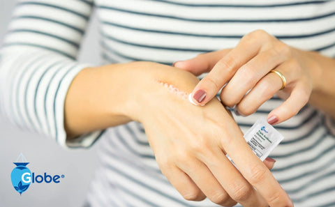 Globe triple antibiotic ointment single-dose 0.9 g packet applied to a small scrape on the back of the hand; Globe logo