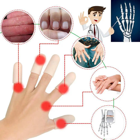 Soft Gel Finger Cots 14 Pack Finger Protector Sleeves For Trigger Finger Hand Eczema Cracking Arthritis Pain Relief Ultra Cozy