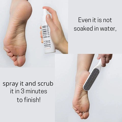 Easy At Home Foot Care Kit With Quick Peel Spray And Foot File Rasp For Callus Removal on bare foot close-up