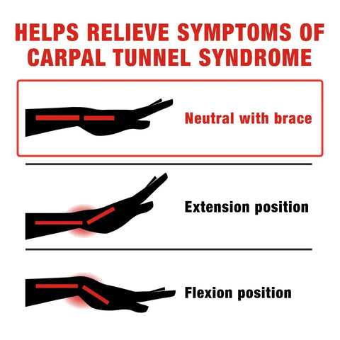 Diagram showing wrist positions with Night Wrist Sleep Support With Adjustable Fit For All Night Comfy, Eases Carpal Tunnel Symptoms, Palmar Splint Wrist Brace For Overnight Relief, Soft And Secure Wear, 12 Packs Per Case.