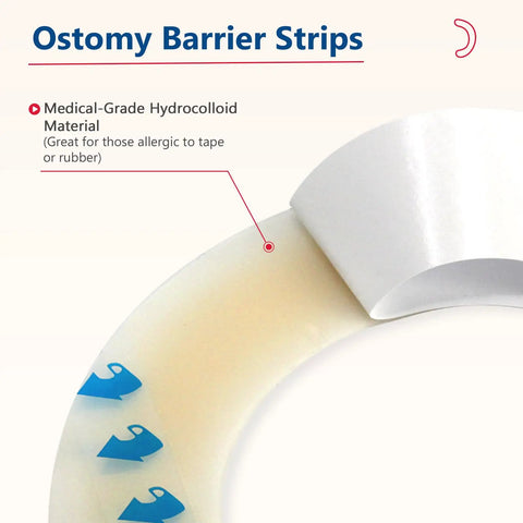 Ostomy Barrier Strips 20 Pack 2mm Thick Elastic Colostomy Tape To Stop Leaks Latex Free Hydrocolloid Material