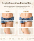 Before and after results using 4 in 1 Lymphatic Drainage Massager With Heat Red Light Vibration And Microcurrent for cellulite reduction