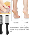 Image showing foot soak and results before and after using All In One 36 In 1 Pedicure Kit For Home And Salon Use With Pro Grade Foot Rasp.
