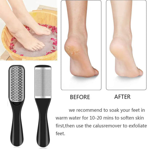 Image showing foot soak and results before and after using All In One 36 In 1 Pedicure Kit For Home And Salon Use With Pro Grade Foot Rasp.