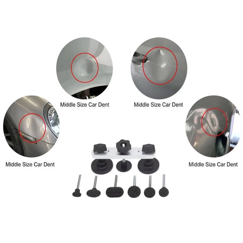Beast 91-Piece Paintless Dent Repair Kit with dent lifter, glue puller tabs for car hail dents, creases, door dings, no paint needed.