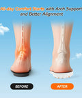 Comparison of foot alignment with and without Soft Cloud Memory Foam Insoles For Women With Heel Shock Pad for better comfort