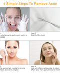 Four steps demonstrating the use of 9-In-1 Pimple Popper Kit With 16 Precision Heads, Blackhead Remover Tools Set for acne removal.