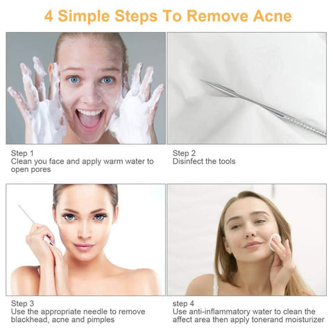 Four steps demonstrating the use of 9-In-1 Pimple Popper Kit With 16 Precision Heads, Blackhead Remover Tools Set for acne removal.